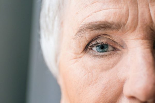 How to Treat Under Eye Wrinkles?