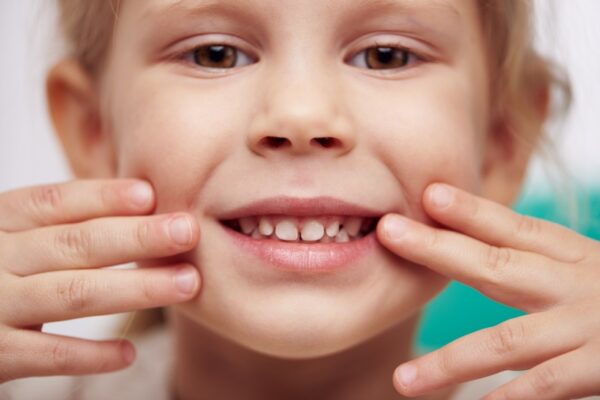 Children’s Dental Issues: What Are They?