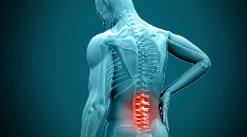 When Must You See A Doctor For Herniated Disk?