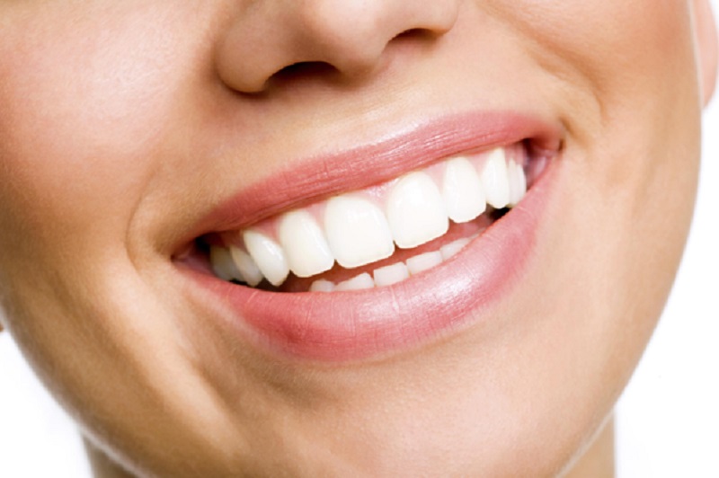 Dazzling Benefits Of Cosmetic Teeth Whitening Services