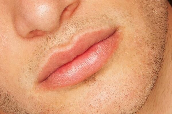 Essential Information About Horn Chestnut Shaped Lip For Men