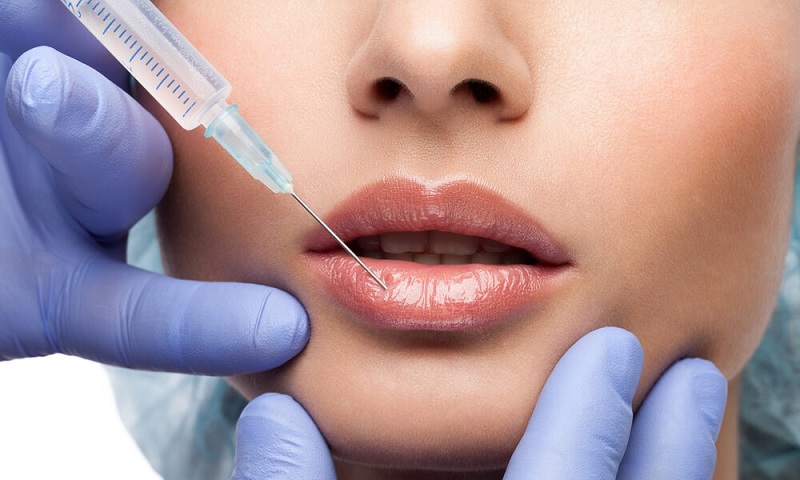 Four Major Advantages Which Make Lip Fillers A Worth Choice