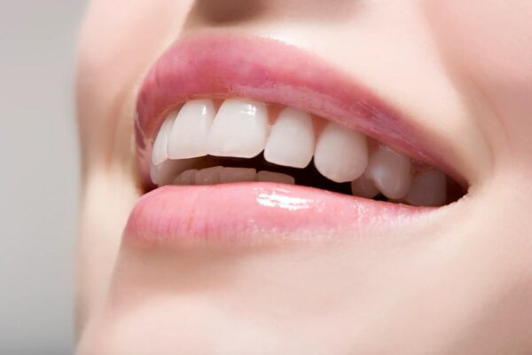 Types of Teeth Whitening Methods