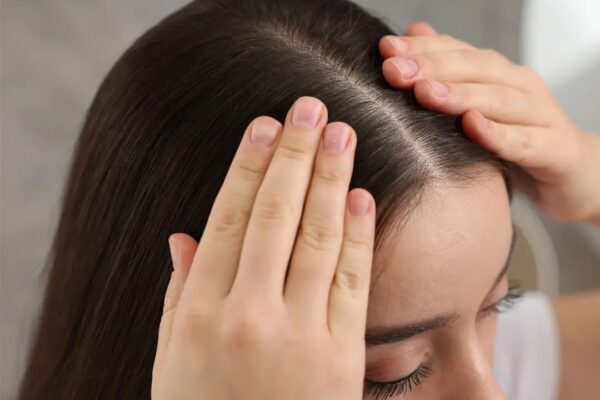 Optimizing Hair and Scalp Health for Long-Term Hair Vitality
