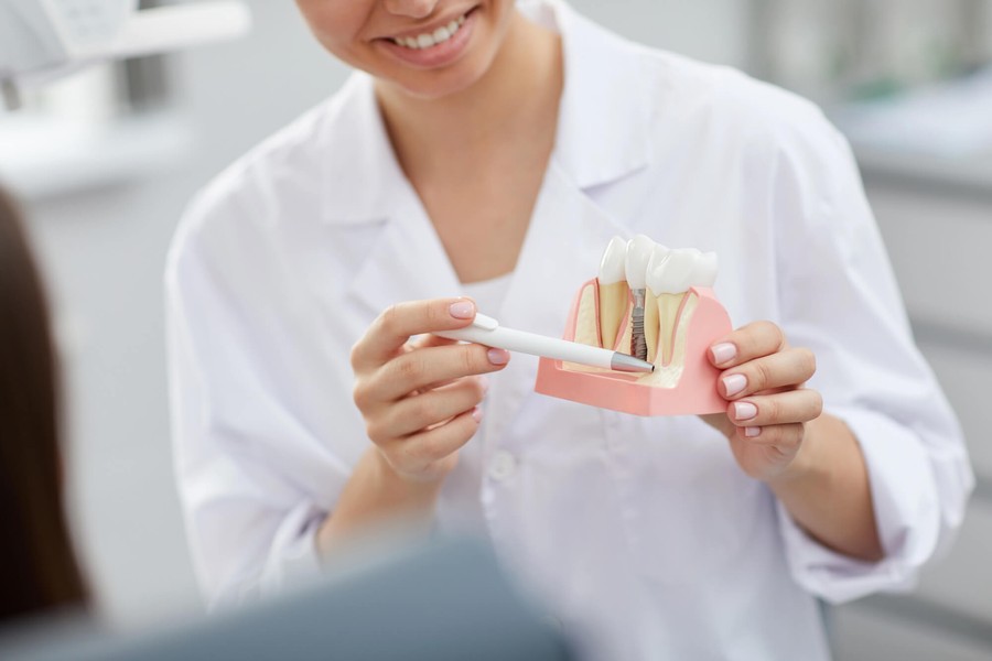 Are You a Candidate for Dental Implants? The Essential Factors Oral Surgeons Consider